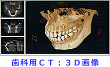歯科用CT：3D画像で顎関節を診断
