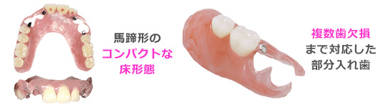 TUMの特徴