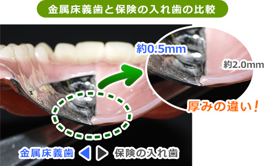 金属床義歯と保険の入れ歯の比較