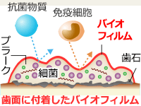 歯周病菌とバイオフィルム