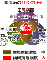 歯周病の危険度・リスク因子