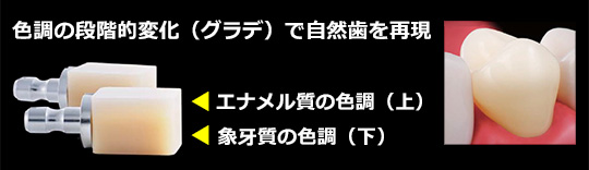 保険適用の小臼歯のかぶせ物（クラウン）：ハイブリッドセラミックスCAD/CAM冠