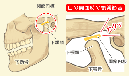 顎関節と口の開閉時の顎関節音